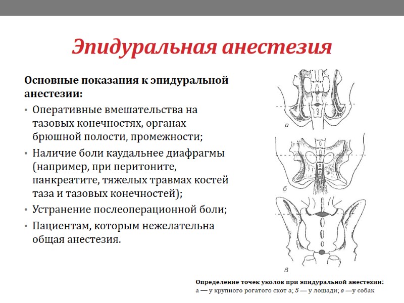 Эпидуральная анестезия Основные показания к эпидуральной анестезии: Оперативные вмешательства на тазовых конечностях, органах брюшной